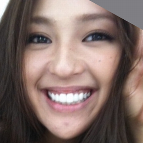 【治療後】23歳のときの中村アンの歯並び画像