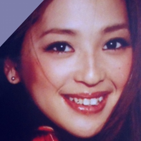 【治療前】21歳のときの中村アンの歯並び画像