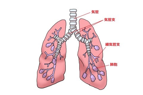 急性気管支炎とは？