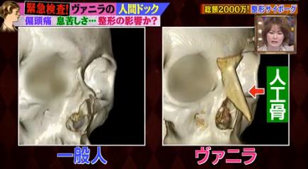 医師5人から整形を止められる