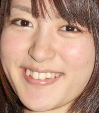 声優 小松未可子が歯の矯正 かわいい画像もたっぷりご紹介 Aikru アイクル かわいい女の子の情報まとめサイト